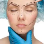 Il Lifting del Viso per il Ringiovanimento Consigli e Prezzi