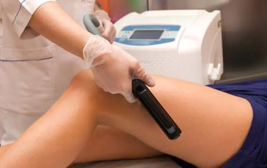 Epilazione Laser Diodo Come funziona e dove farla