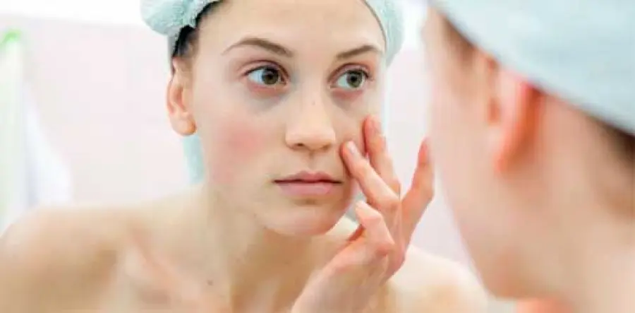 Rimedi contro le Occhiaie