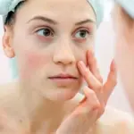 Rimedi contro le Occhiaie