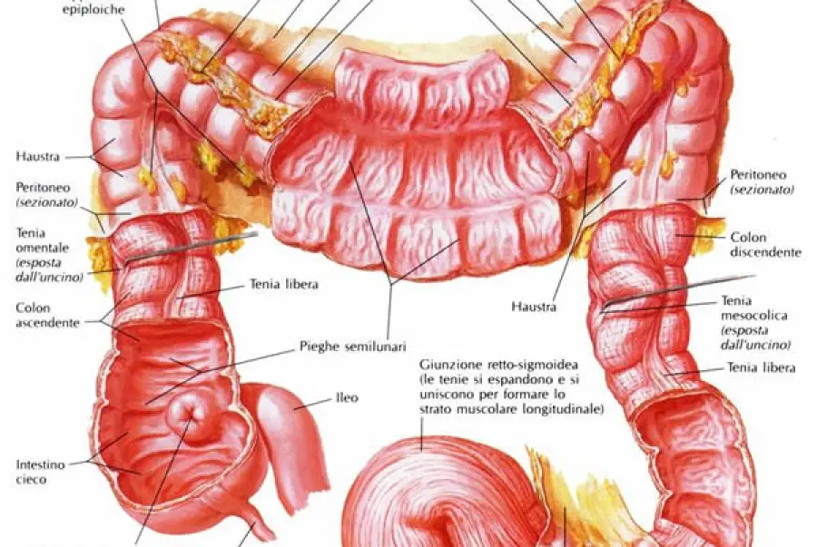 Sintomi malattia di Crohn