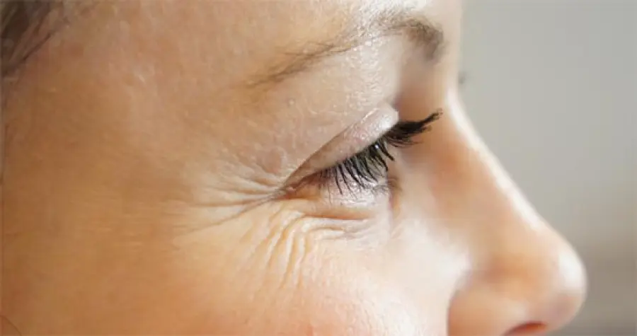 Biorimodellamento del Viso per contrastare l'Invecchiamento