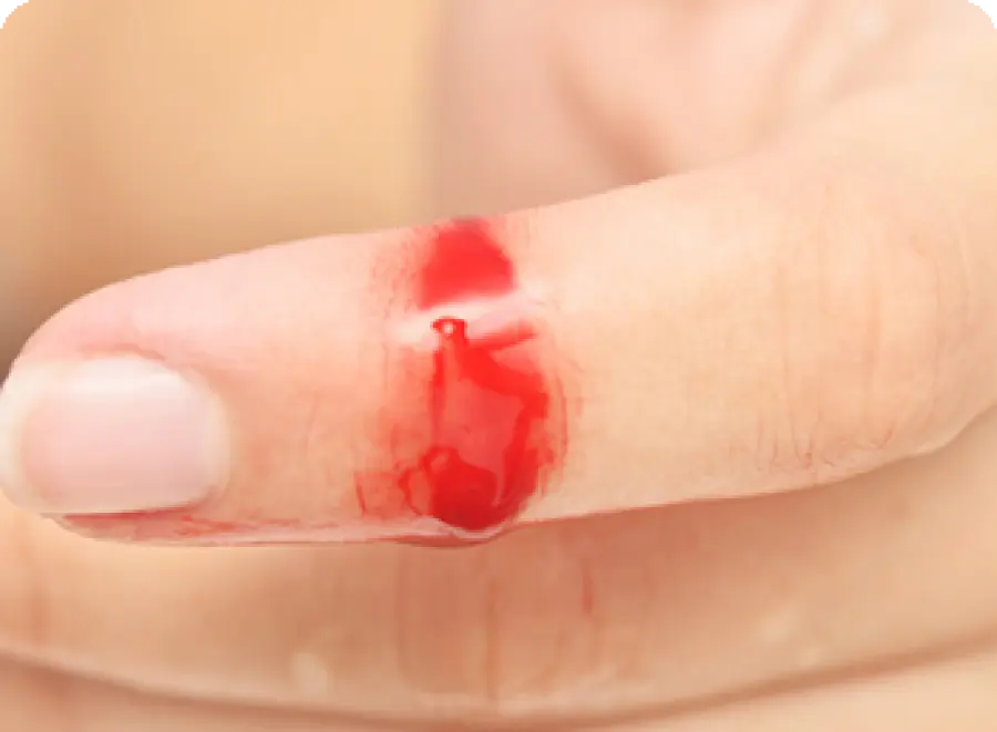 Come Curare Escoriazioni e Piccole Ferite