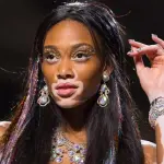 Come Curare la Vitiligine Fototerapia e Trapianto